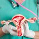 linfadenectomia cancer cuello utero cirugia robotica hospital la salud