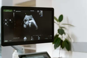 Ecografía en el embarazo: cómo la nueva tecnología mejora el diagnóstico prenatal