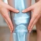 imagen rodilla con prótesis